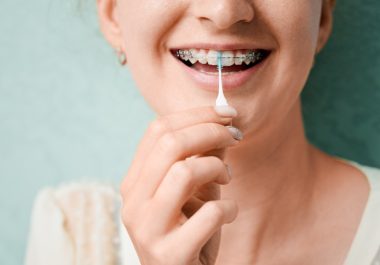 How-to-floss-with-braces-a-guide-to-healthy-teeth-and-gums