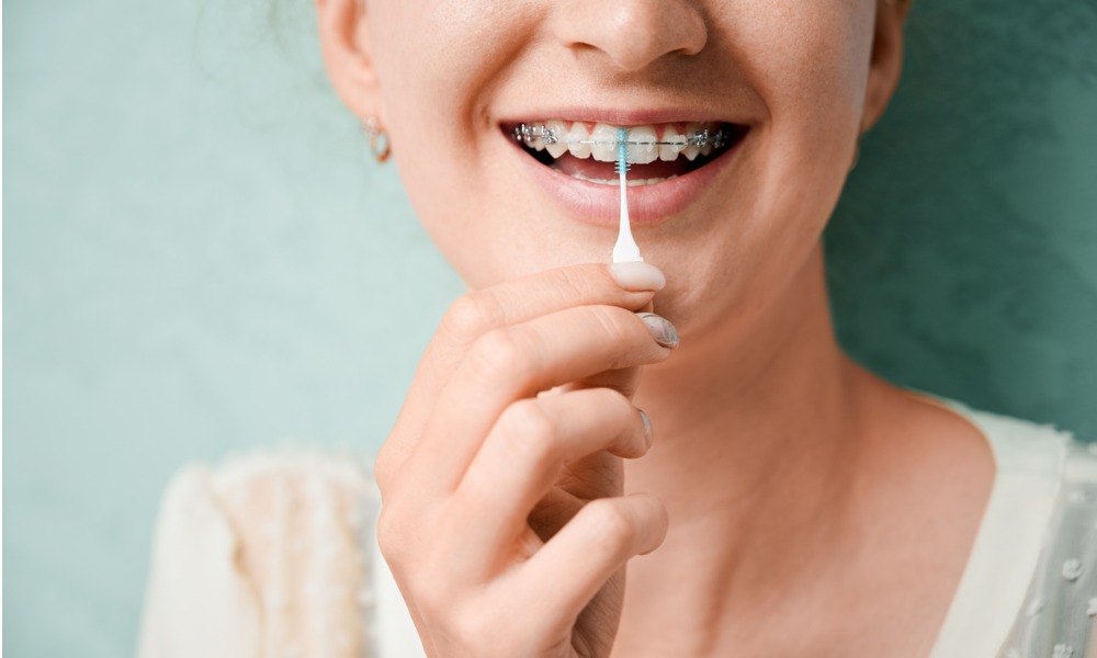 How To Floss With Braces: A Guide To Healthy Teeth And Gums